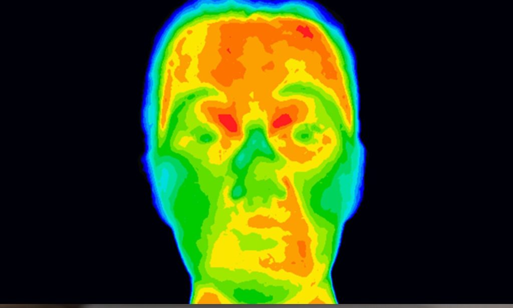 what can full body thermography detect